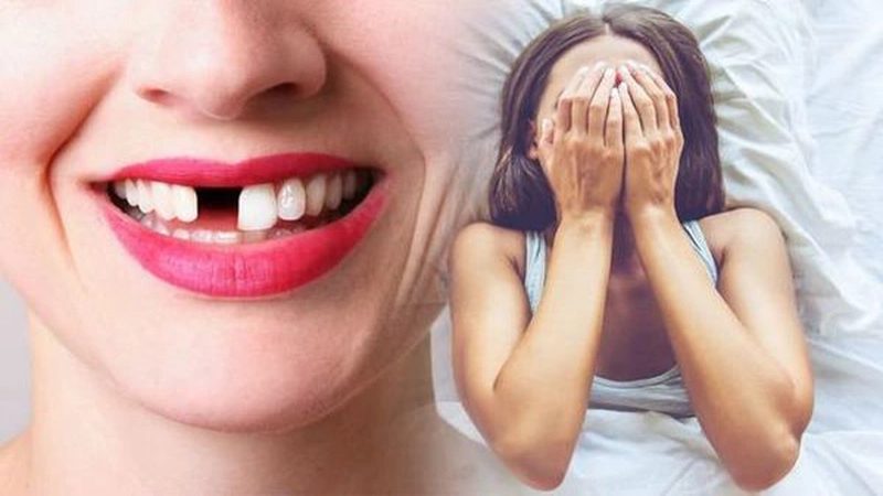 Nằm mơ rụng răng đ&aacute;nh con g&igrave; khi đang ở nh&agrave; người lạ
