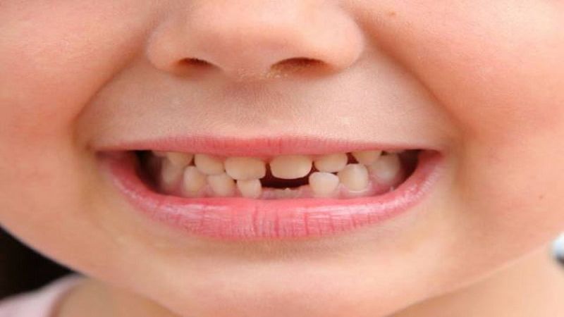 Giải m&atilde; b&iacute; ẩn về giấc mơ thấy rụng răng&nbsp;